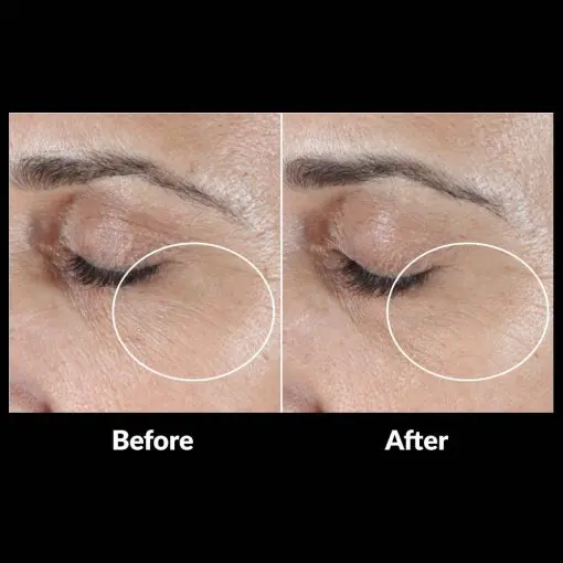 SkinMedica® HA5 Rejuvenating Hydrator