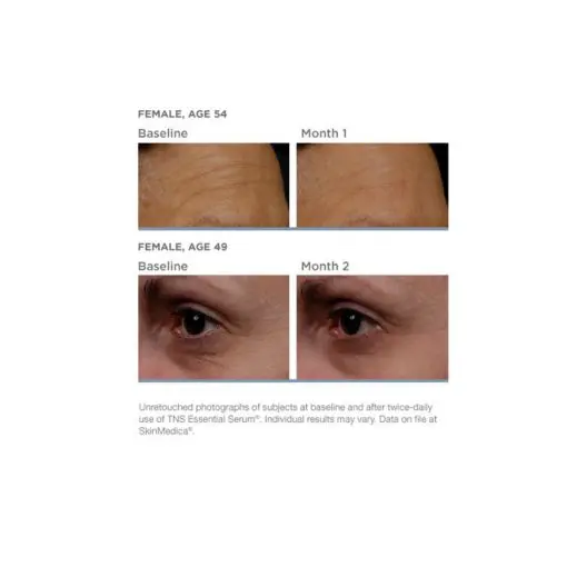 SkinMedica® TNS Advanced+ Serum®