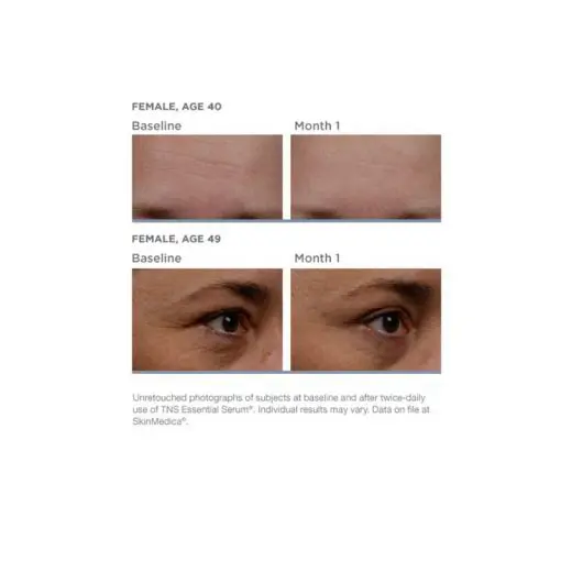 SkinMedica® TNS Advanced+ Serum®