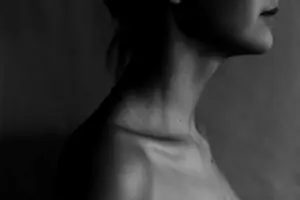 What to Expect with Your Neck Lift Procedure: A Step-by-Step Guide What to Expect with Your Neck Lift Procedure: A Step-by-Step Guide