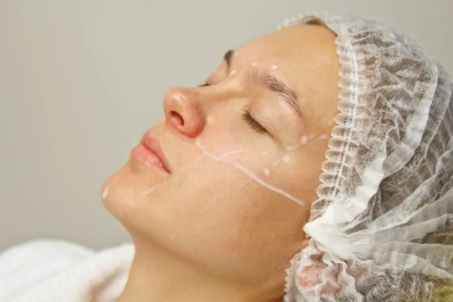 Mini Facelift Procedure-What It Is And How It Works Mini Facelift Procedure-What It Is And How It Works