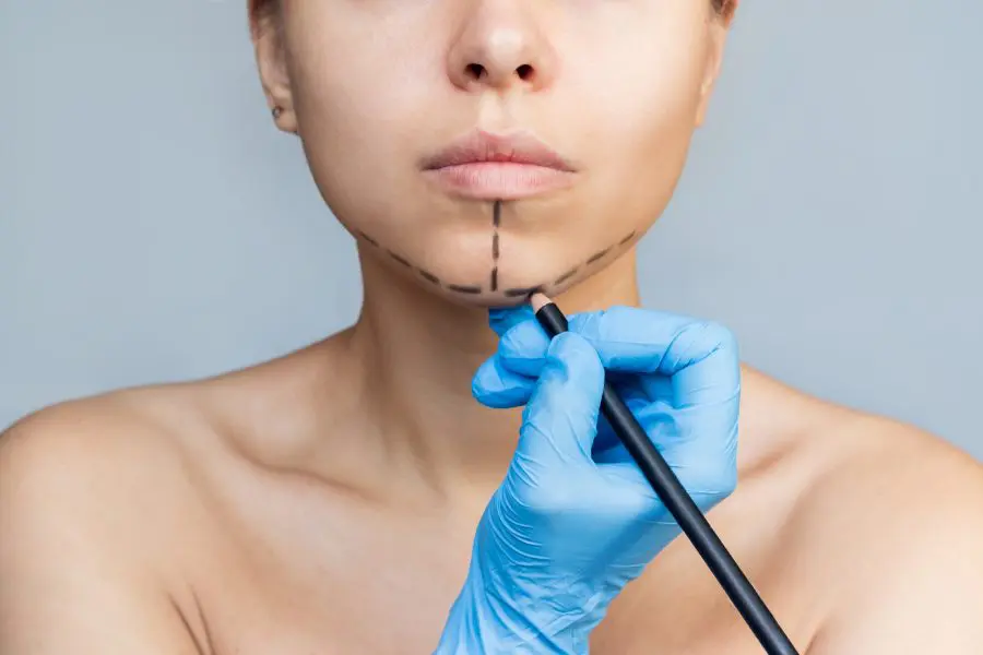 More about the mini facelift process More about the mini facelift process