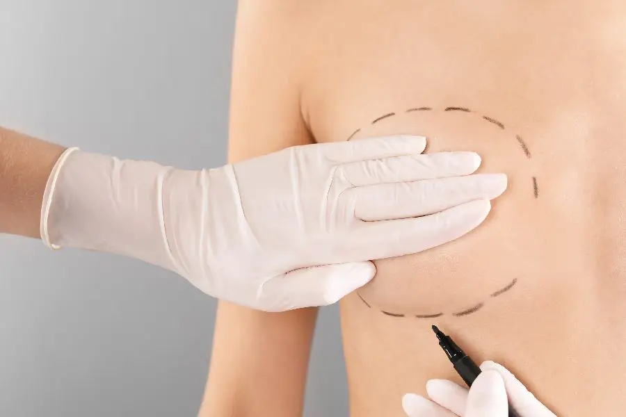 What Other Essentials Should You Prepare for After Breast Augmentation Surgery What Other Essentials Should You Prepare for After Breast Augmentation Surgery