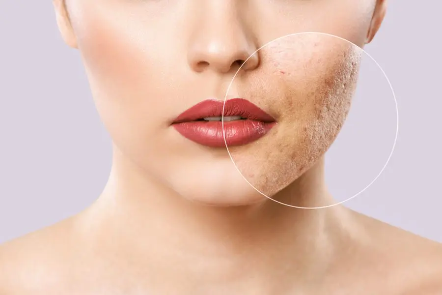 Can Plastic Surgery Get Rid of Scars