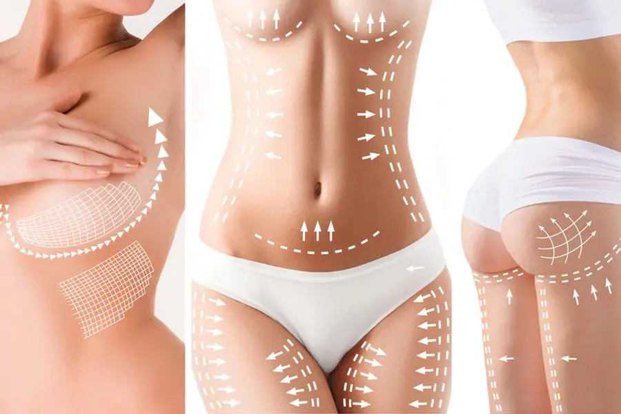 Types of Plastic Surgery Types of Plastic Surgery