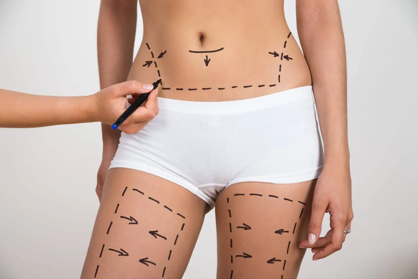 What Cosmetic Surgery Is Covered by Insurance What Cosmetic Surgery Is Covered by Insurance