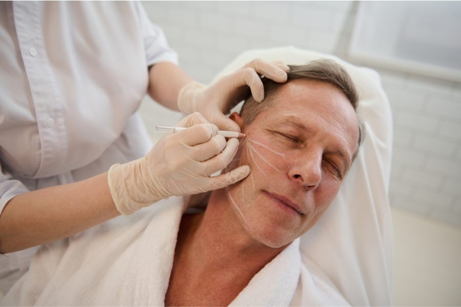 How a Deep Plane Facelift Is Performed