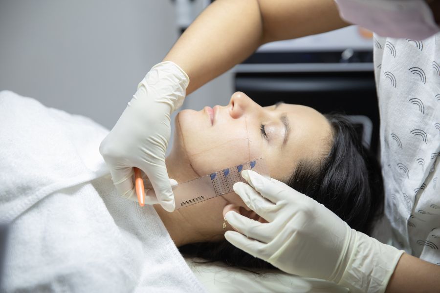 Facial Rejuvenation Surgery Guide - How Does a Facelift Work