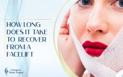 How Long Does It Take to Recover From a Facelift?