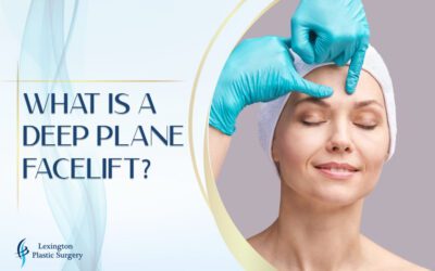 What Is a Deep Plane Facelift?
