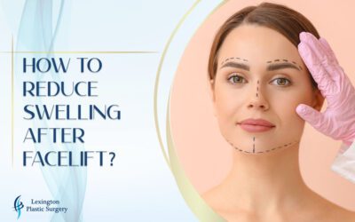 How to Reduce Swelling After Facelift