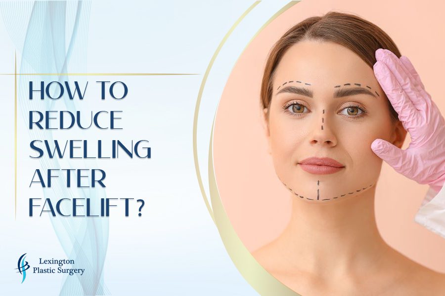 how-to-reduce-swelling-after-facelift-effective-tips-and-tricks