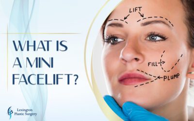What is a Mini Facelift?