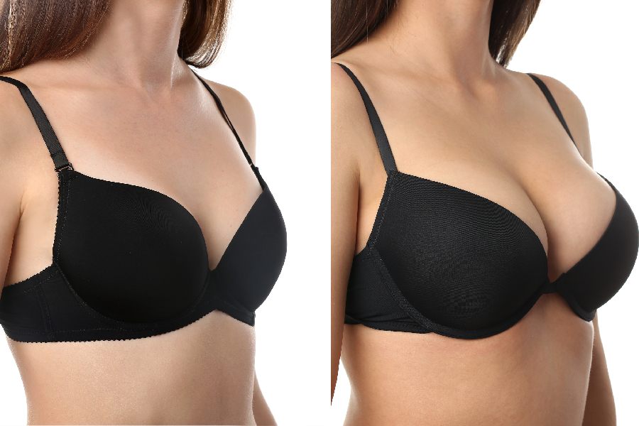 Finding the Right Surgical Bra_ What to Look For