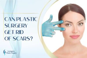 Can Plastic Surgery Get Rid of Scars