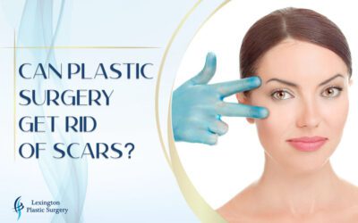 Can Plastic Surgery Get Rid of Scars?